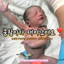 다정의원 | 금빛여성의원 제왕절개 출산 입원 장단점 솔직후기