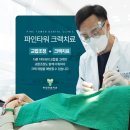 파인타워치과의원 네이버블로그