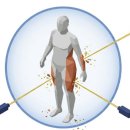 도건호마취과의원 | 위고비/마운자로 시대에지방흡입이 여전히 필요한 이유