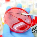 (주)세기개발 | 🧬 ACXP 아크럭스 파머슈티컬스 분석 | 항생제 내성 치료제 개발 바이오 기업 전망