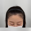 선헤어라인 - 종로구 | 선헤어라인