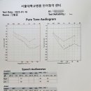 보청기 바꿔야하는데 고민이 있어요:) 이미지