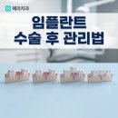 이심는연합치과의원 | 헤리치과 나사방식 헤리 임플란트 수술 후 관리법