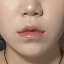 빨간입술 | 리뷰 / 내돈내산 말린 입술 필러 후기: 아띠에르 vs 뉴라미스