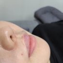 썬헤어라인 이미지