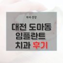 대전 서구 도마동 치과 임플란트 비용 가격 후기 잘하는 병원 14곳 총정리