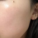 민감성 피부 한 번에 진정됐던 세럼 마이리예 미백효과 솔직후기