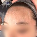 고양 리뉴 에스테틱 스킨 바디에서 관리받고 환절기 피부 걱정 해결했어요
