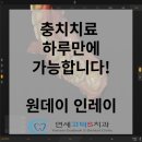 우성치과기공소 | 충치치료ㅣ원데이인레이ㅣ세라믹인레이