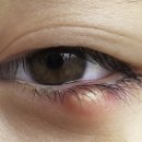 구미더원안과의원 이미지