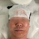 사창산 | 청주 윤곽관리 맛집, 에스테티아 사창1호점 남자 윤곽관리 리얼 후기