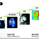 암 환자의 병원검사 활용하기 X-ray, CT, PET, MRI, 조직검사 이미지