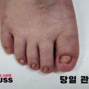 레푸스 사상점 이미지