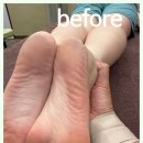 바른체형교정 마사지센터 이미지