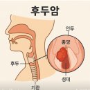 [공지] 후두암 수술후기 발성장해 인정받아 보험금 전액 수령한 비결