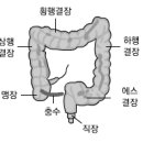 국가 5대 암 - 대장암 이미지