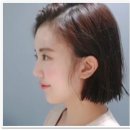 이마성형 이뽀졌어