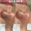 청주가경동에스테틱 여름철 피부관리 방법!