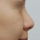 슈어스성형외과의원 네이버블로그