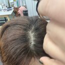 루비셀뷰티랩천안백석점 | 두피스케일링 추천! 줄기세포 리프팅과 전체염색까지 한 번에 해결하는 루비셀 뷰티랩 천안백석점 추천