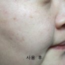 레코토너 이미지