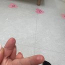 32개월 아기) 2도 화상치료 후기. 대전연세화사외과