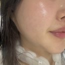 여름약국 | 여름 피부장벽 관리 고민이라면? 약국크림 지피덤 EGF크림 솔직후기