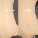 일성메디칼 | 연산동피부관리 &#34;리하에스테틱&#34; 테라노바 다이어트 추천 🔌