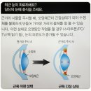 아이피아 안경원 이미지