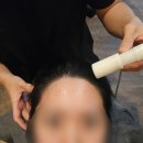 탑스칼프인천점 | 인천 탈모 구월동 탈모 구월동 두피관리 탑스칼프 인천점 복합성 두피관리 후기