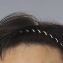 임마누엘헤어 이미지