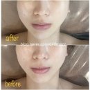 아름다운빛휴 | [여주] #여주얼굴윤곽관리 아름다운빛 휴
