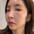 모아사 | 덕천역피부과 미글로우리프팅, 처진턱라인 윤곽관리 받아본 후기