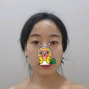 부천 상동 물광피부, 로비엘에서 찾다!