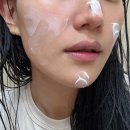 아시아 피부 | 덱스판테놀크림 민감성 피부 트러블 관리 후기