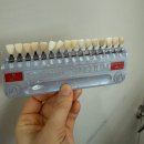 김희정치과의원 | 서면치아미백치과 결혼을 앞두신 커플 후기