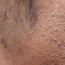 권피부과의원 이미지