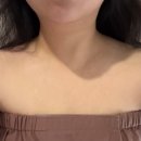 부산카크리닉 | 서른네번째 글, 어스제이스킨클리닉덴스리프팅후기(feat. 신상리프팅기계덴스후기)