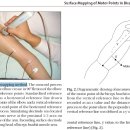 Surface Mapping of Motor Points in Biceps Brachii Muscle 이미지