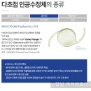 스마일PC | 20대 스마일라식부터 50~60대 노안백내장 수술가이드(아이리움안과 강성용원장)