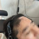 진주왁싱관리 토탈샵 뷰티텐 헤어라인왁싱후기