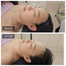 [서울/건대입구] 광진에스테틱 &#39;올가드림뷰티&#39; 모공 디톡스