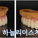 하늘치과기공소 네이버블로그