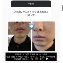 더팬시 | [내돈내산] 유라이크 제모기 쿨링 팬시 구매후기(러브지나 인스타 공구)/제모효과/턱수염 사용 후기