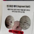 남천1-212 | 광안리왁싱 추천! 프라이빗하고 덜 아픈 브라질리언 왁싱 남천동 러비왁싱 후기!