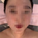 피부아지트(뉴페이스) 이미지