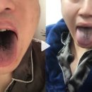 청주중국한의원 네이버블로그