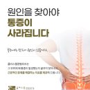 클라스웰정형외과의원 네이버블로그