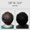 청주본가 충북혁신도시점 | 청주/충북혁신도시 두피문신 디피스칼프가 '점의 밀도'에 목숨 거는 이유(고해상도 확대 사진 공개)