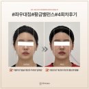인계동 218-6 | 인계동경락? 후기보다 중요한 &#39;이것&#39;